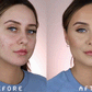 Mabox Award Winning Acne Clarifying Vitamin C Serum