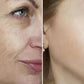 Mabox Award Winning Acne Clarifying Vitamin C Serum